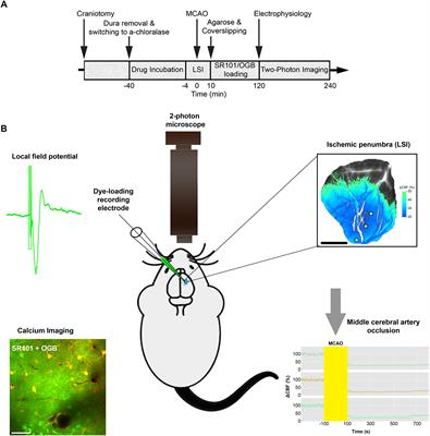 Sensory Stimulation-Induced Astrocytic Calcium Signaling in Electrically Silent Ischemic Penumbra